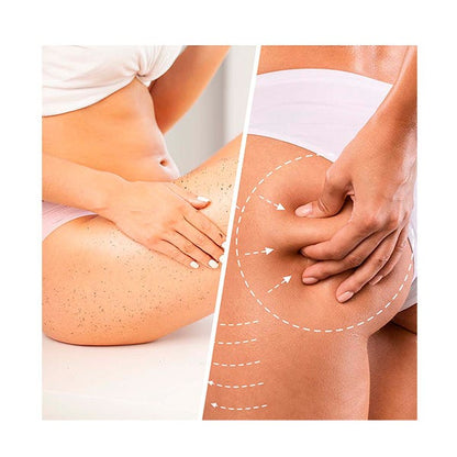 BIOVENE - Gommage Corps Anti-Cellulite Niacin Cellulite Scrub